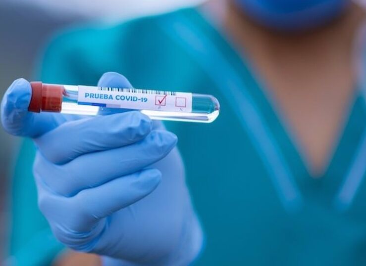 Extremadura ha realizado 306977 pruebas PCR y supera media nacional de test rpidos